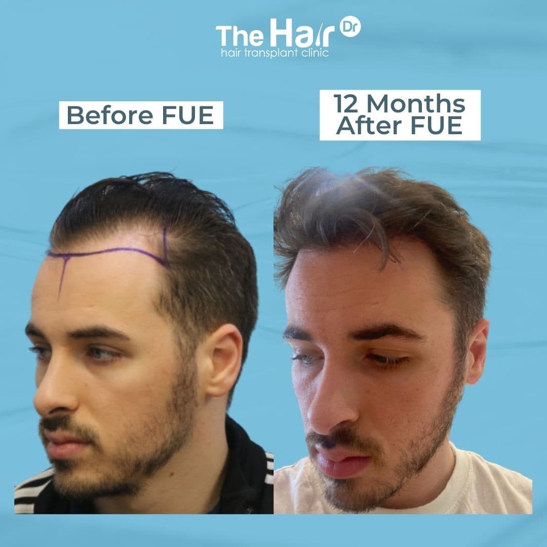 Patient transformation slide 6
