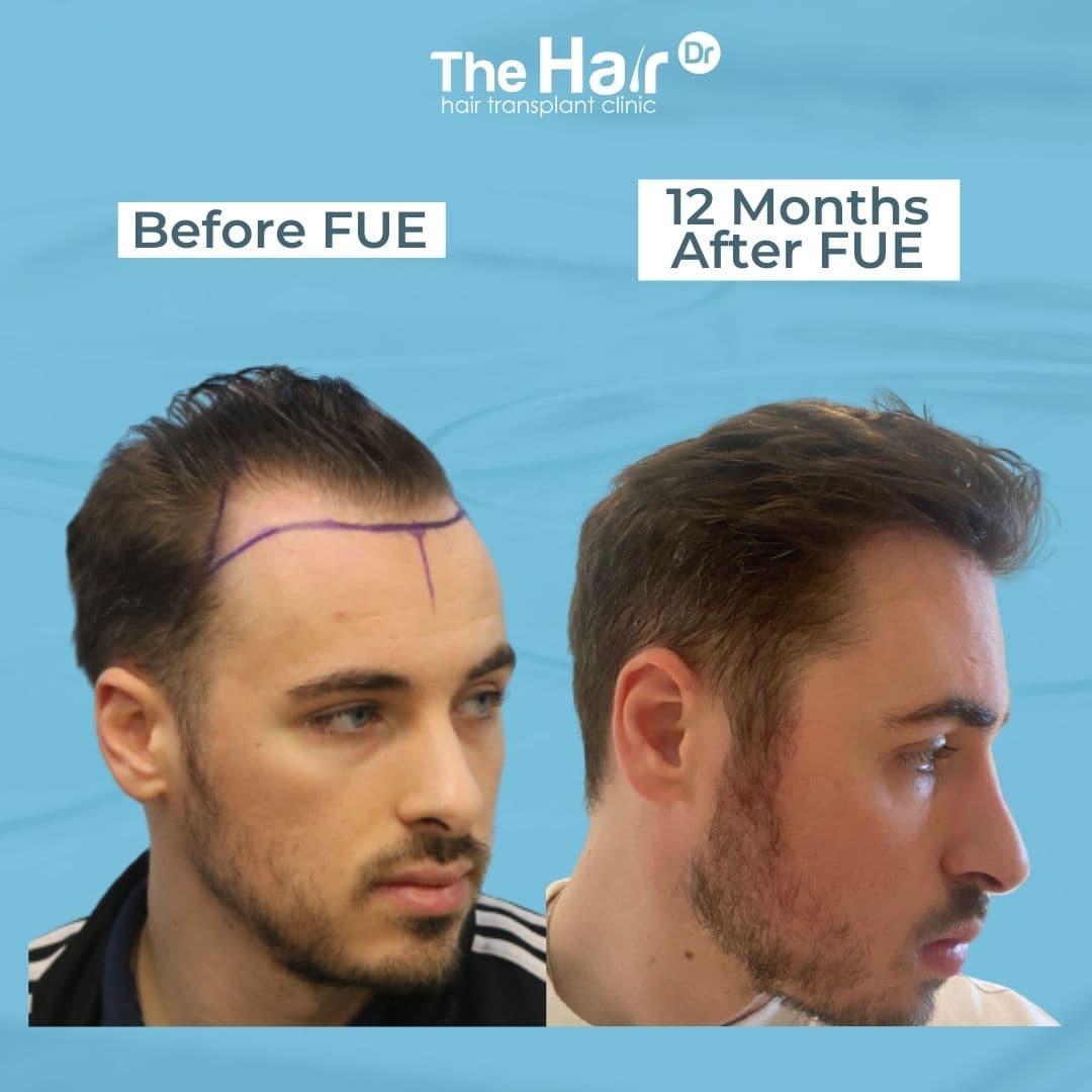 Patient transformation slide 2