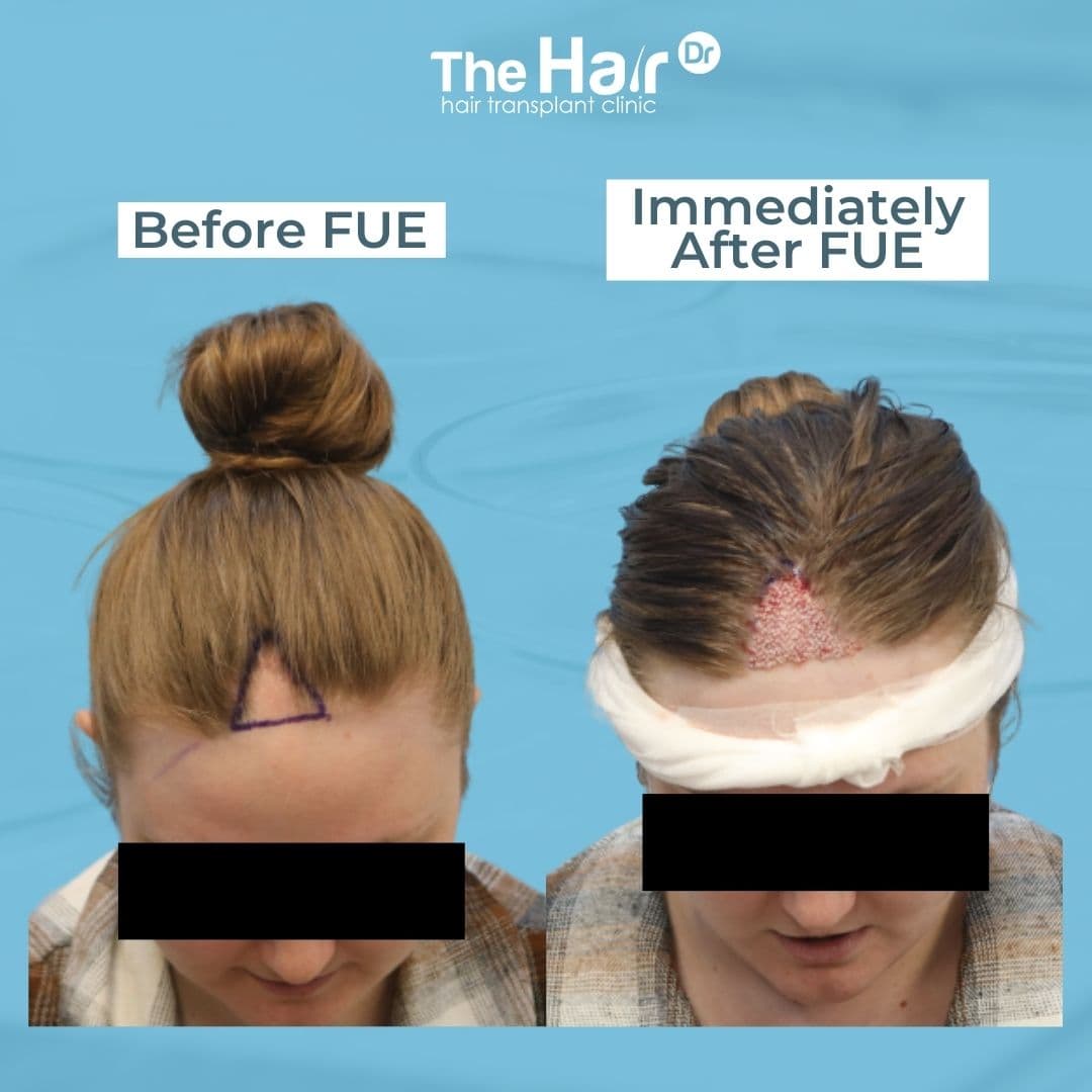 Patient transformation slide 4