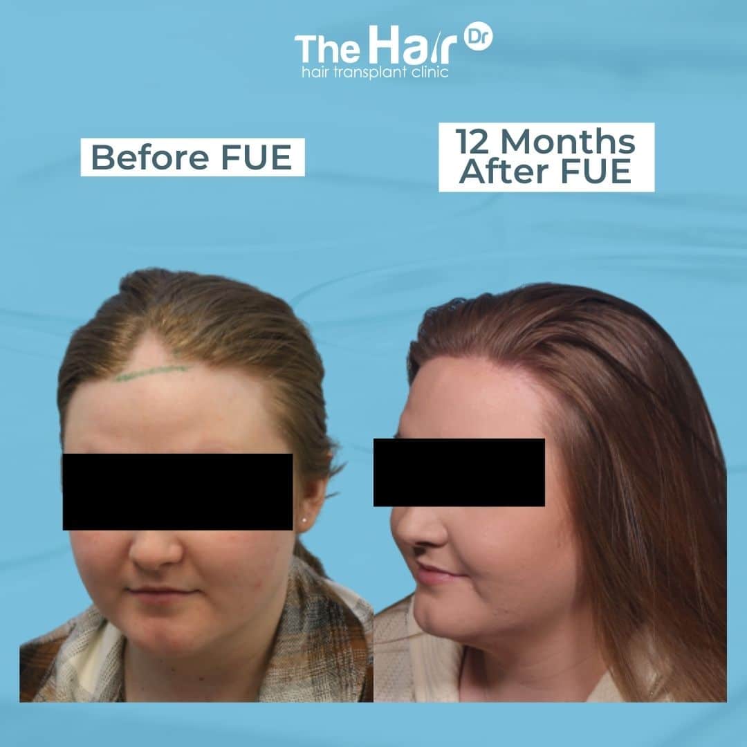 Patient transformation slide 6