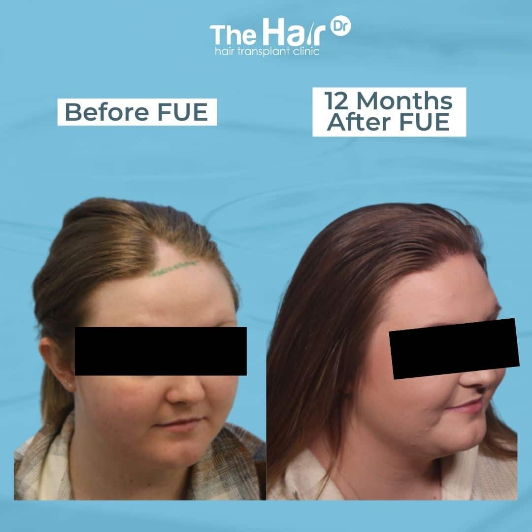 Patient transformation slide 7