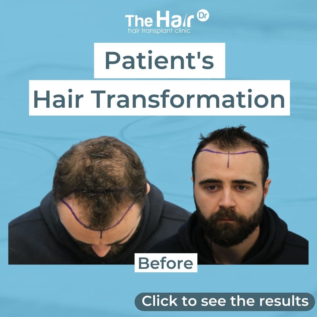 Patient transformation slide 1
