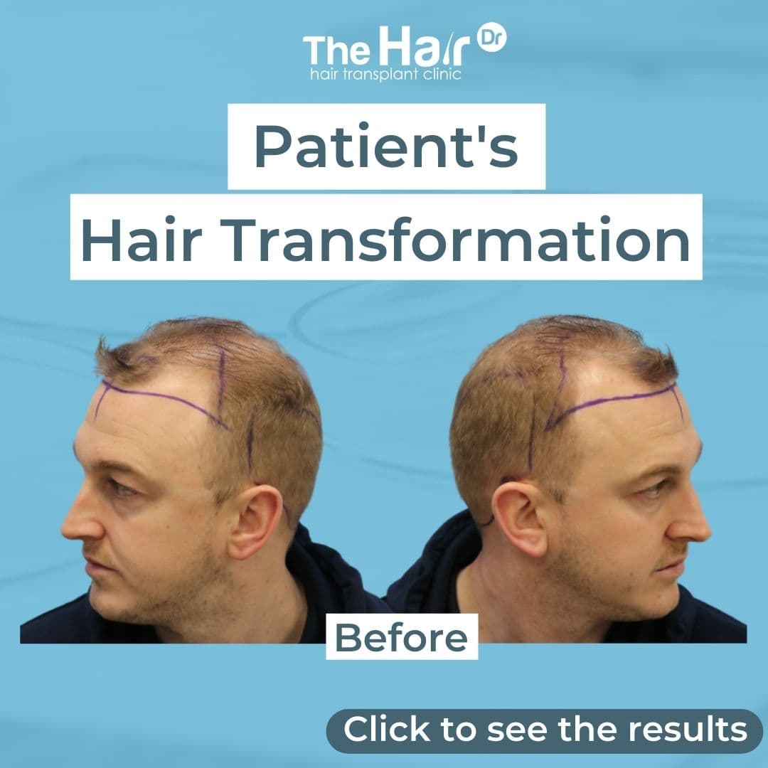 Patient transformation slide 1