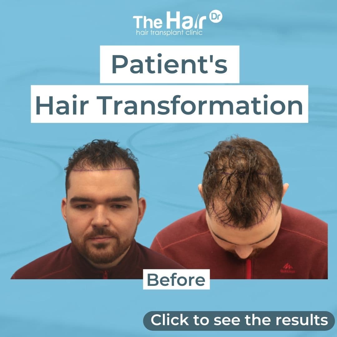 Patient transformation slide 1