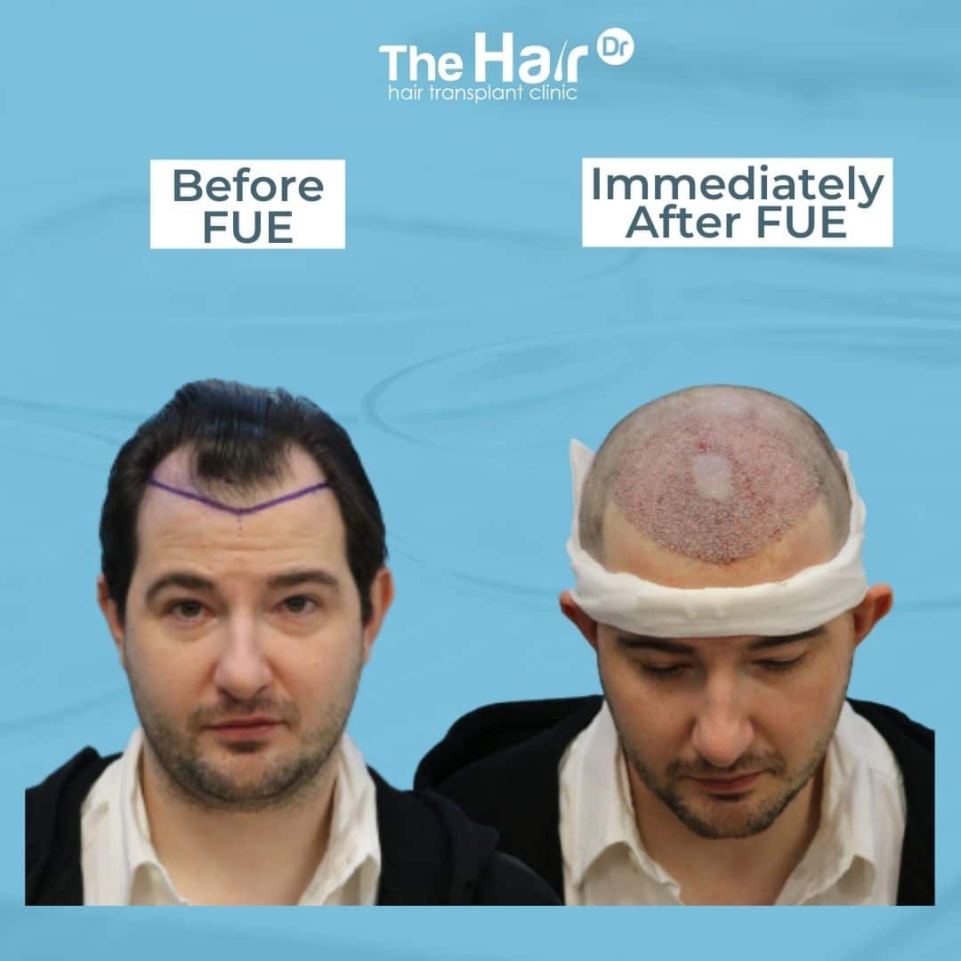Patient transformation slide 3