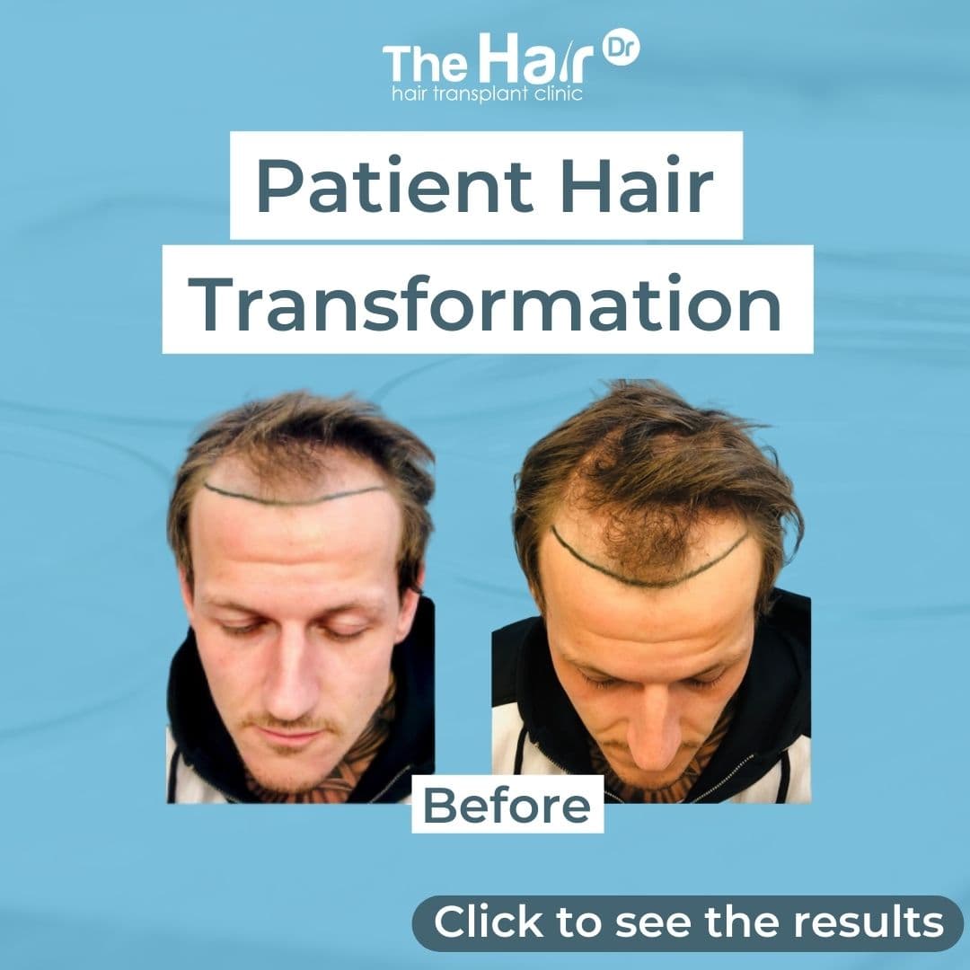 Patient transformation slide 1