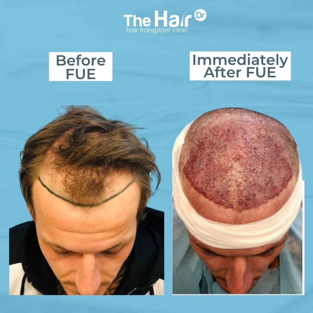 Patient transformation slide 2