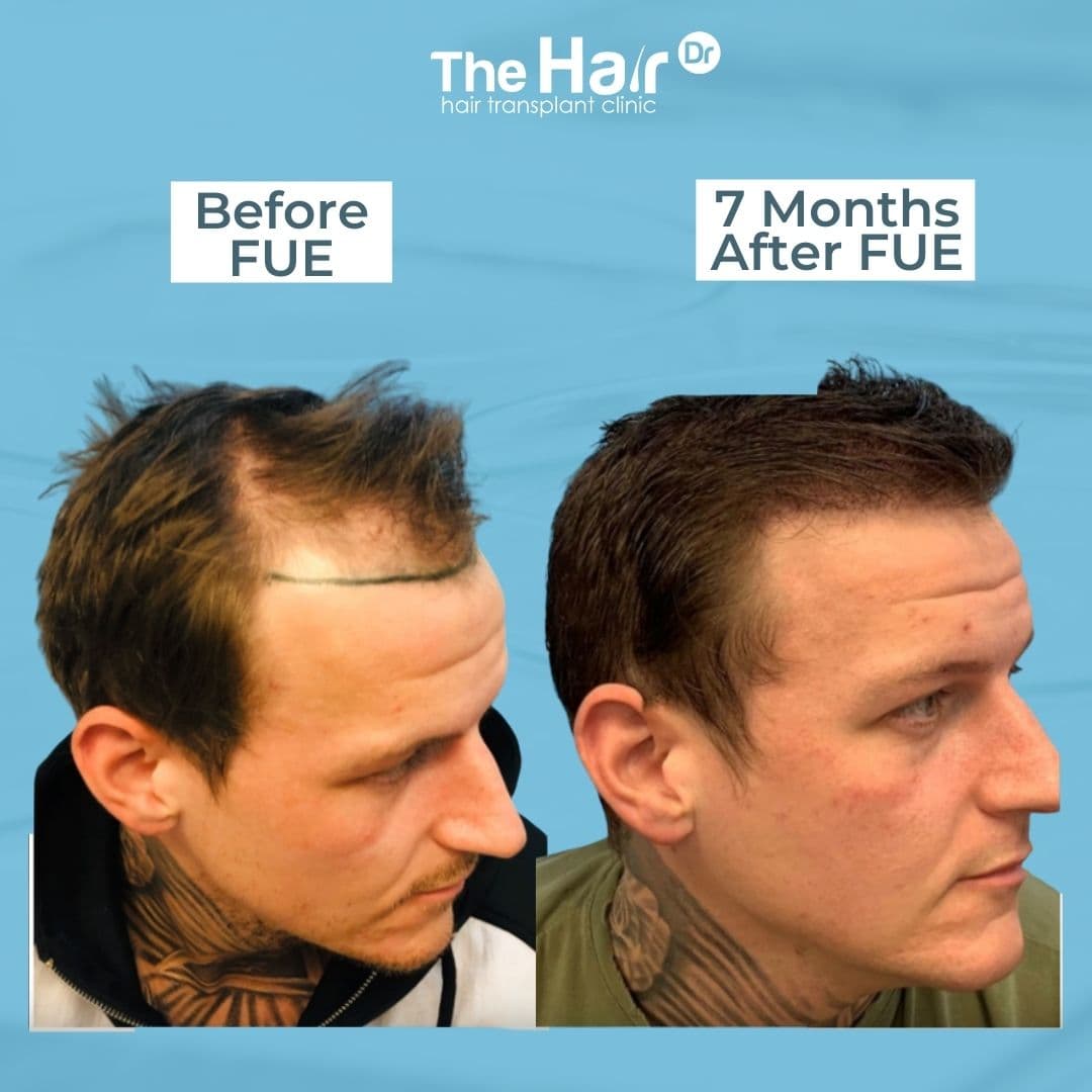 Patient transformation slide 3