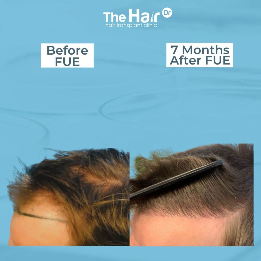 Patient transformation slide 6