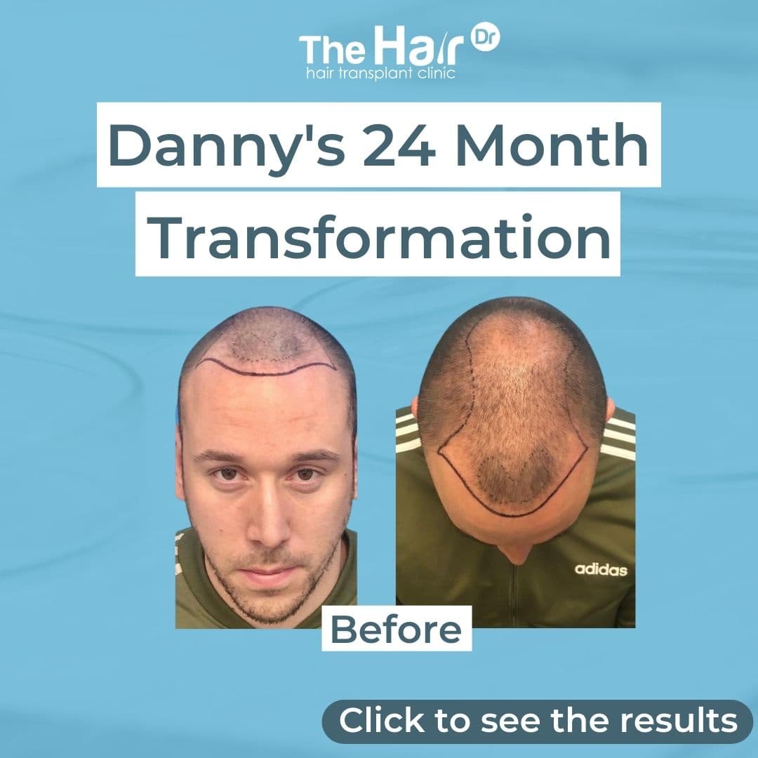 Patient transformation slide 1