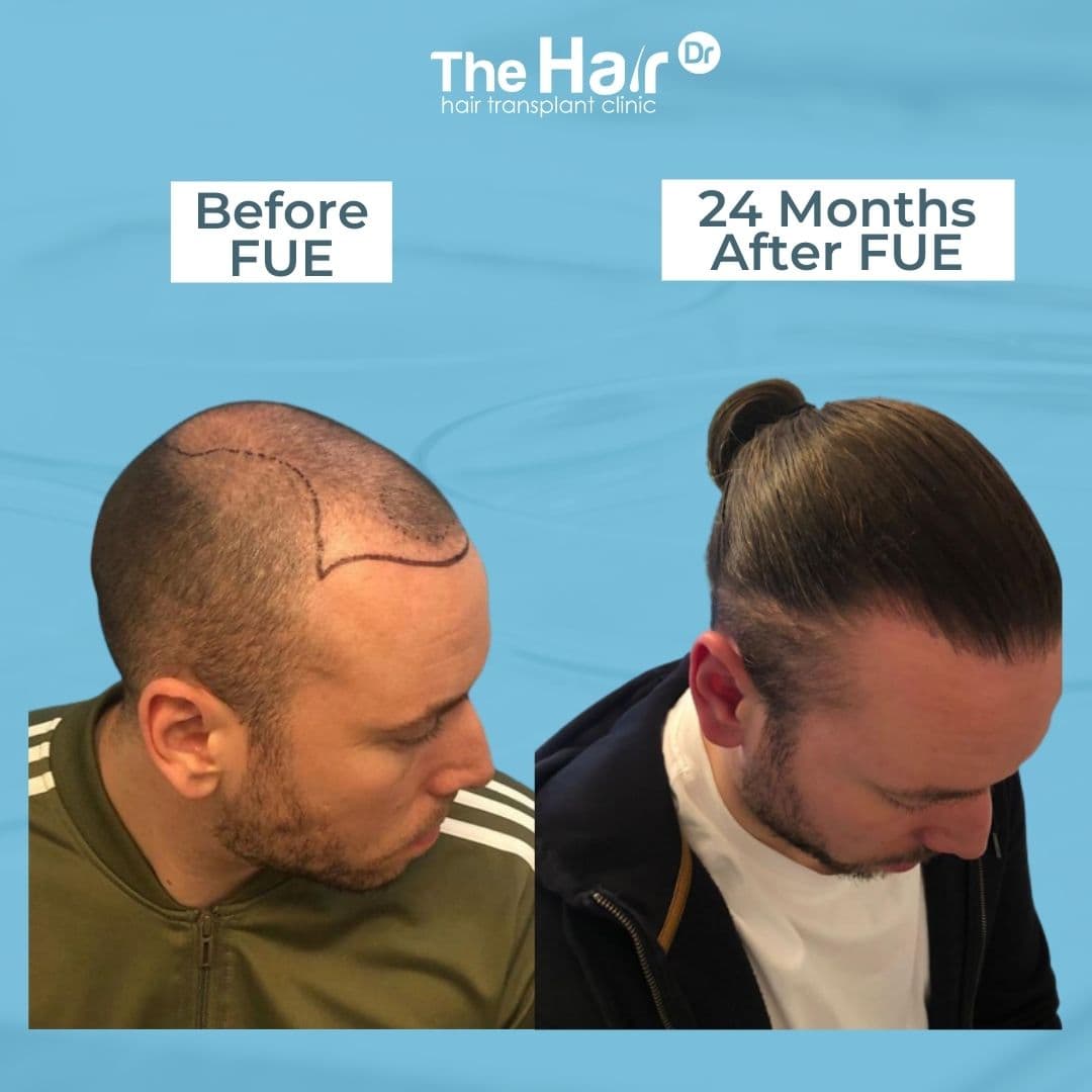 Patient transformation slide 3