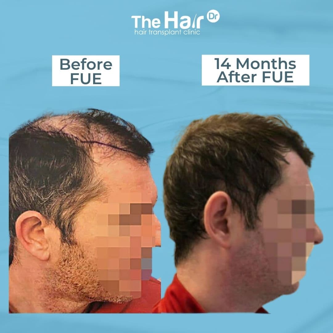 Patient transformation slide 3