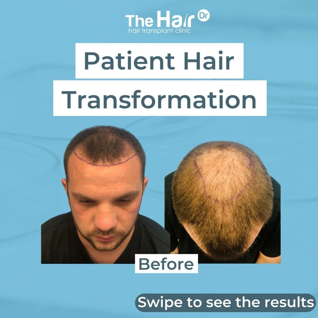 Patient transformation slide 1