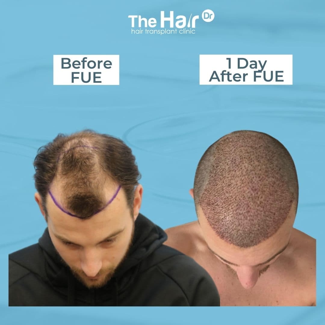 Patient transformation slide 3