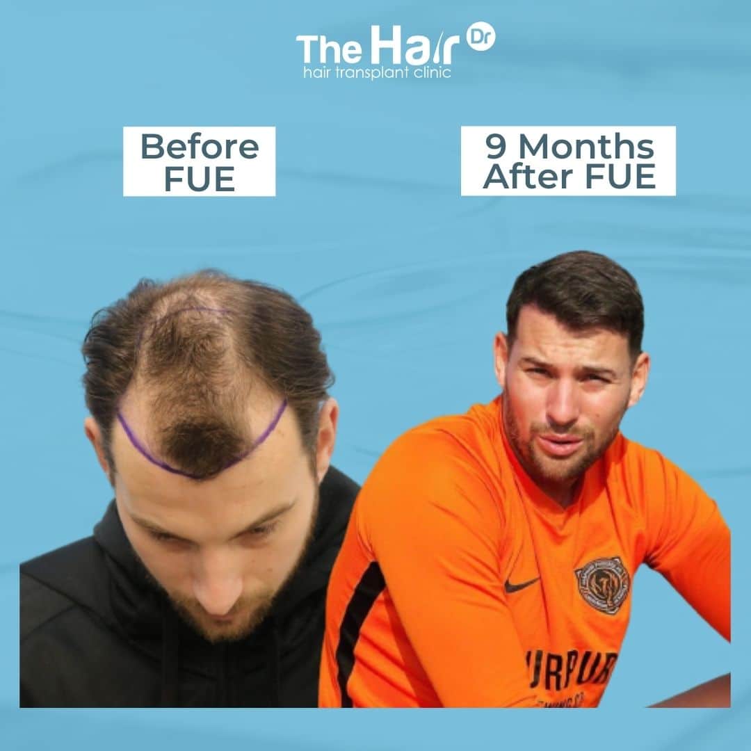 Patient transformation slide 8