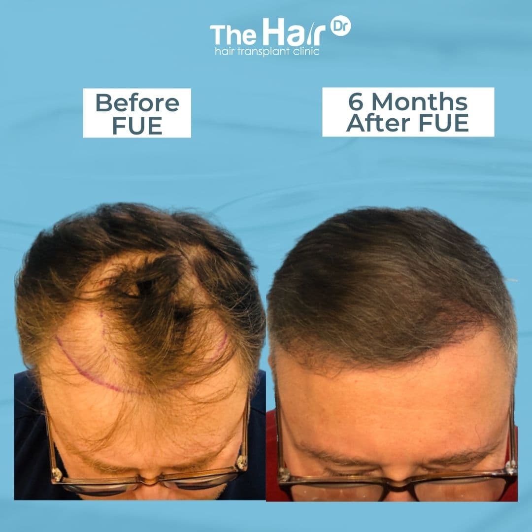 Patient transformation slide 3
