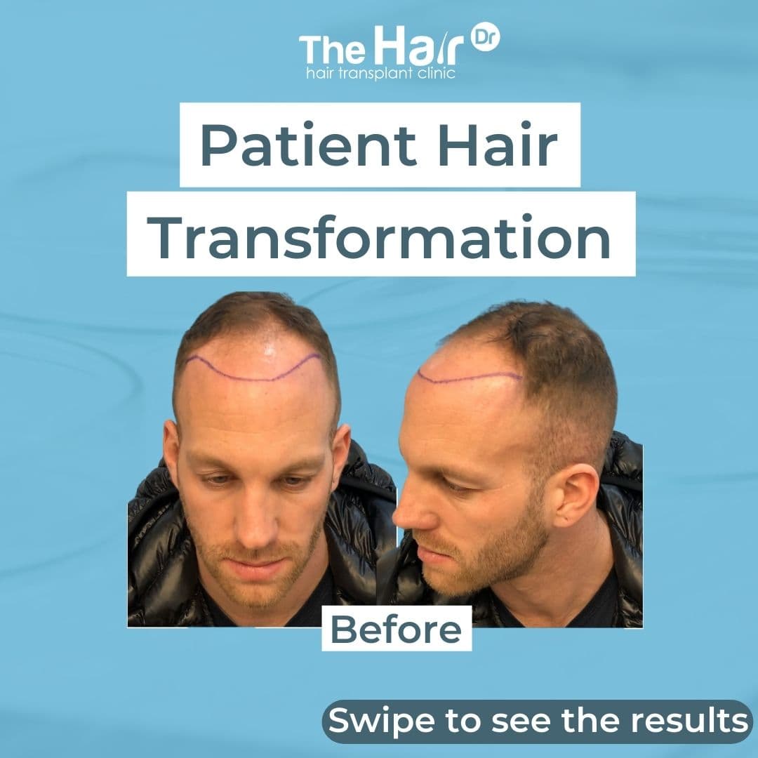Patient transformation slide 1