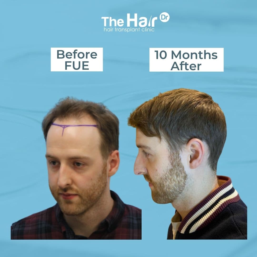Patient transformation slide 6