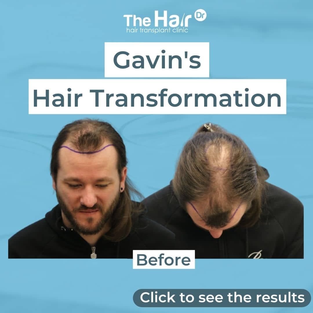Patient transformation slide 1