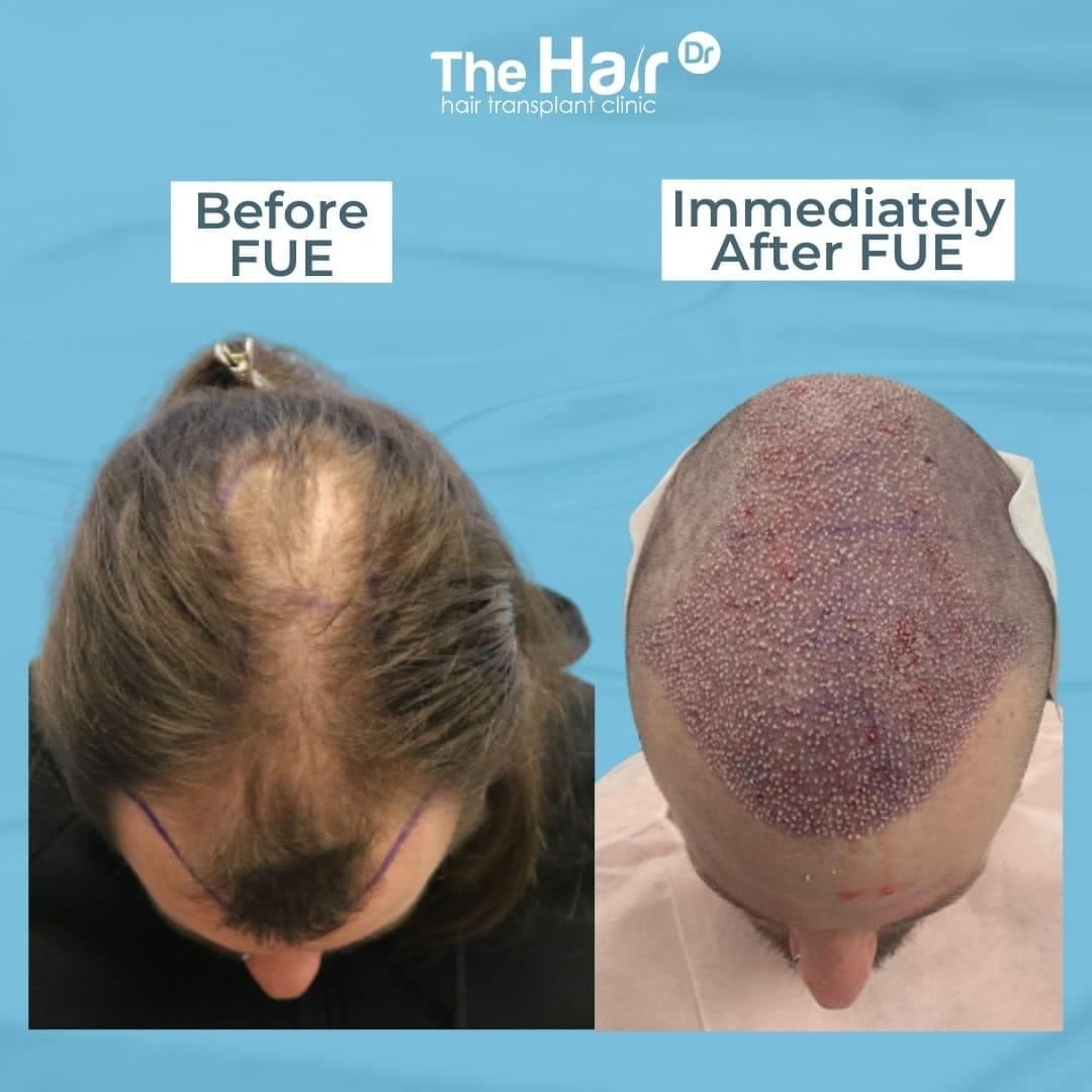 Patient transformation slide 3