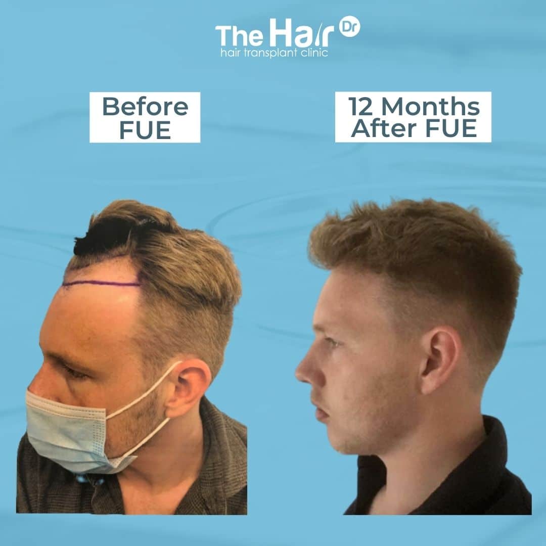 Patient transformation slide 3