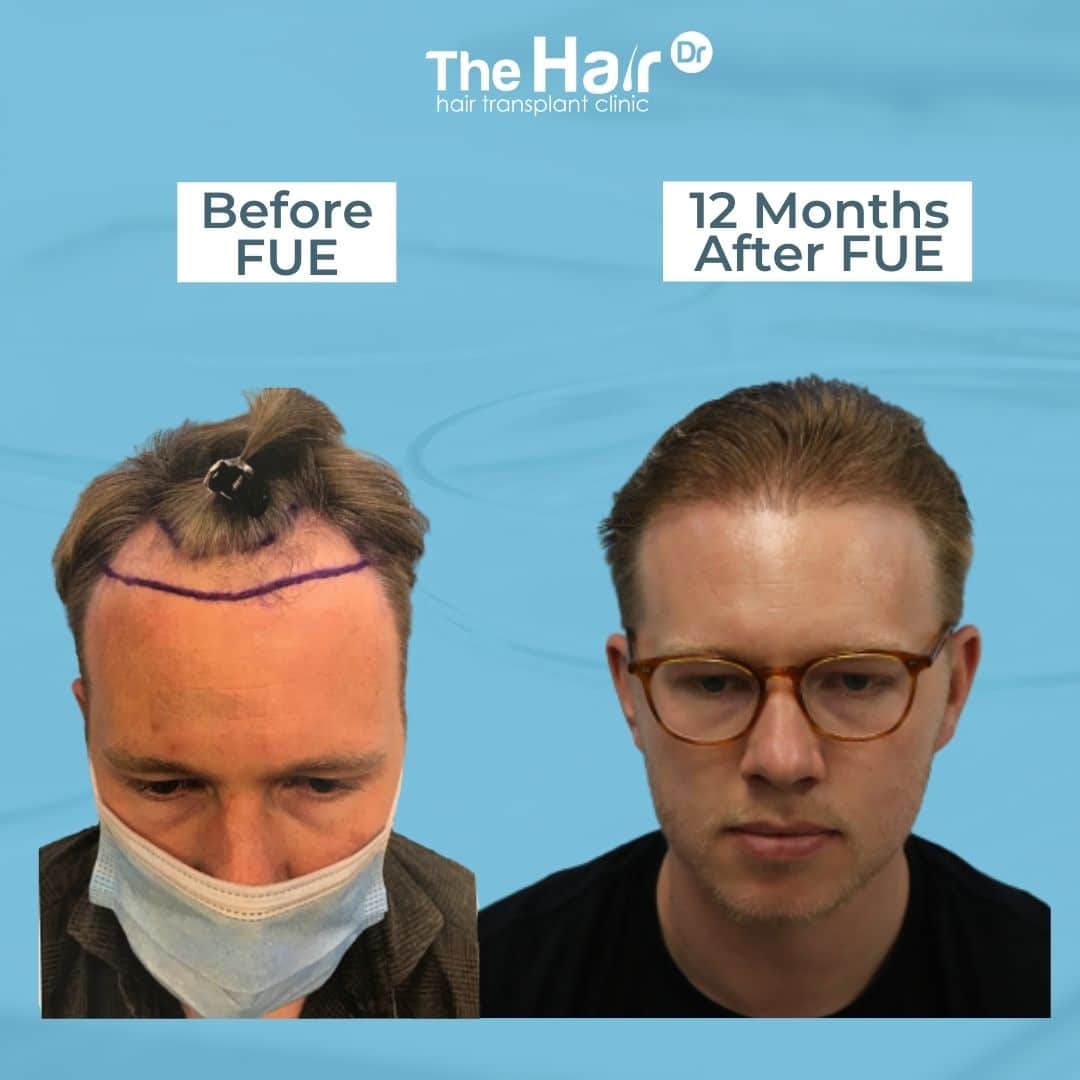 Patient transformation slide 6