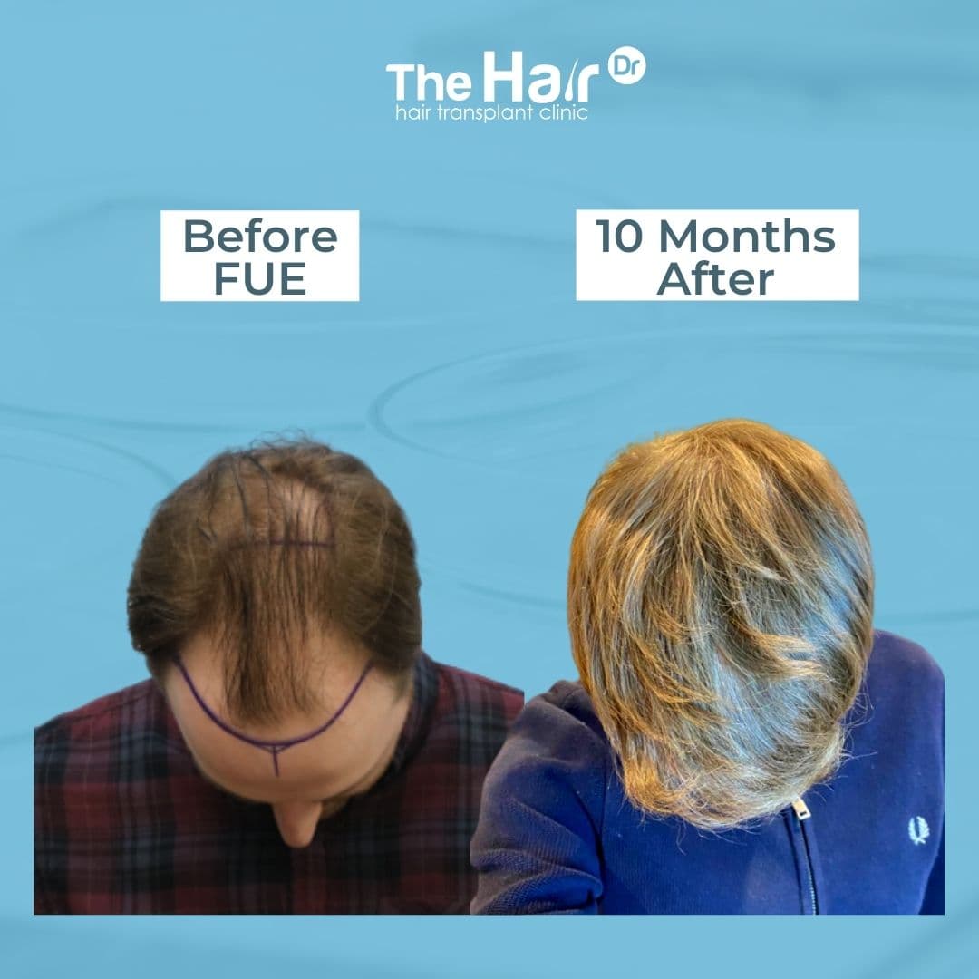 Patient transformation slide 7