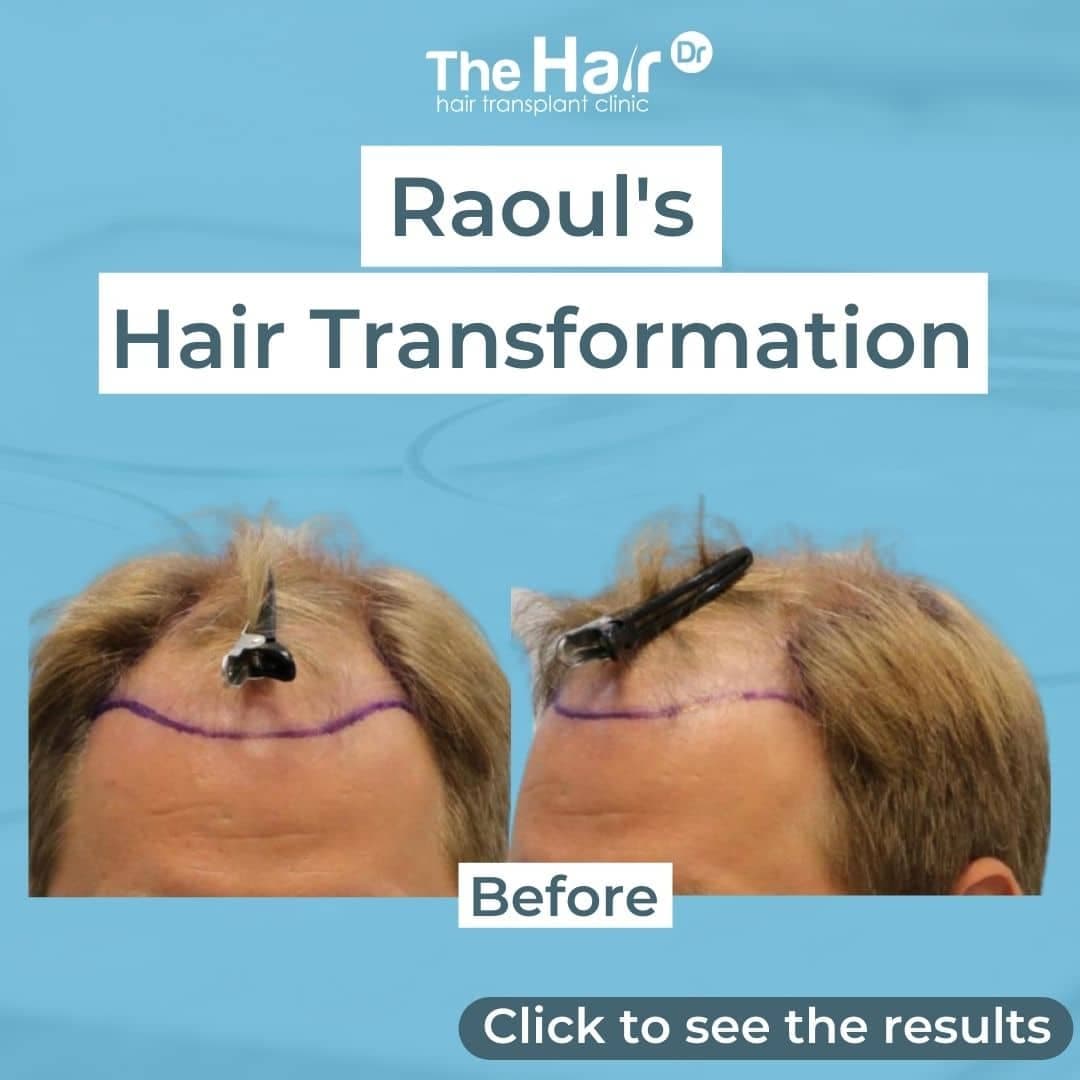 Patient transformation slide 1