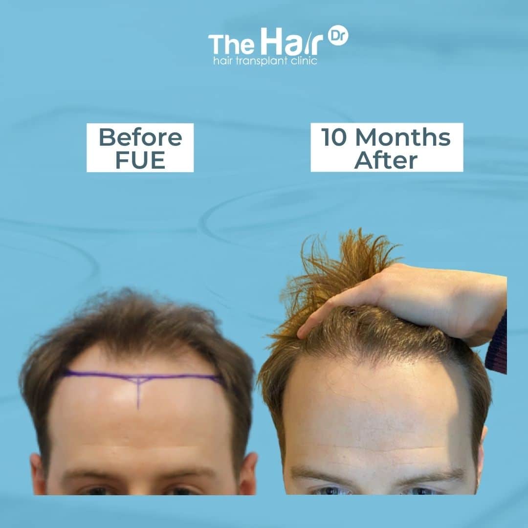 Patient transformation slide 8