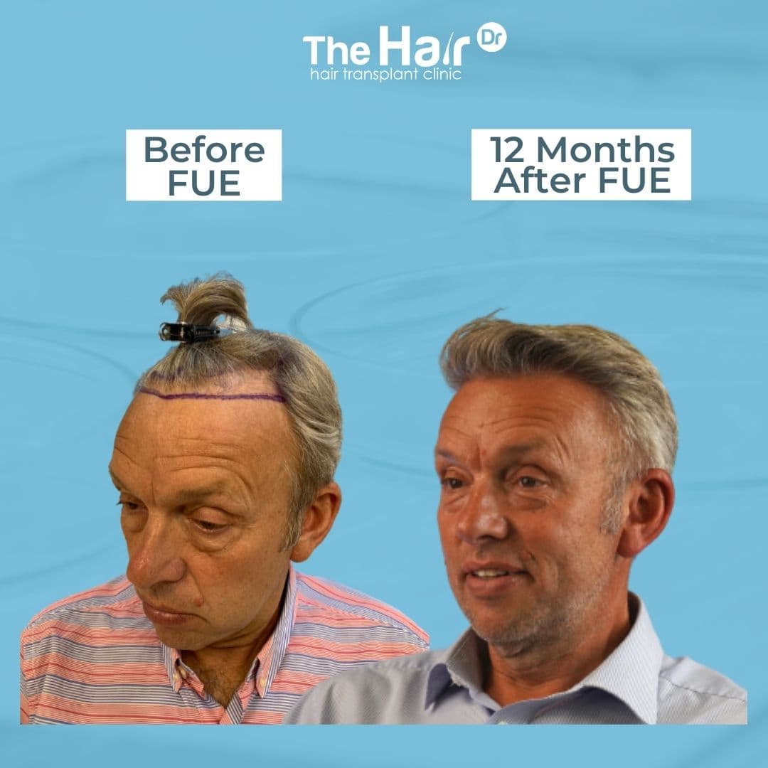 Patient transformation slide 4