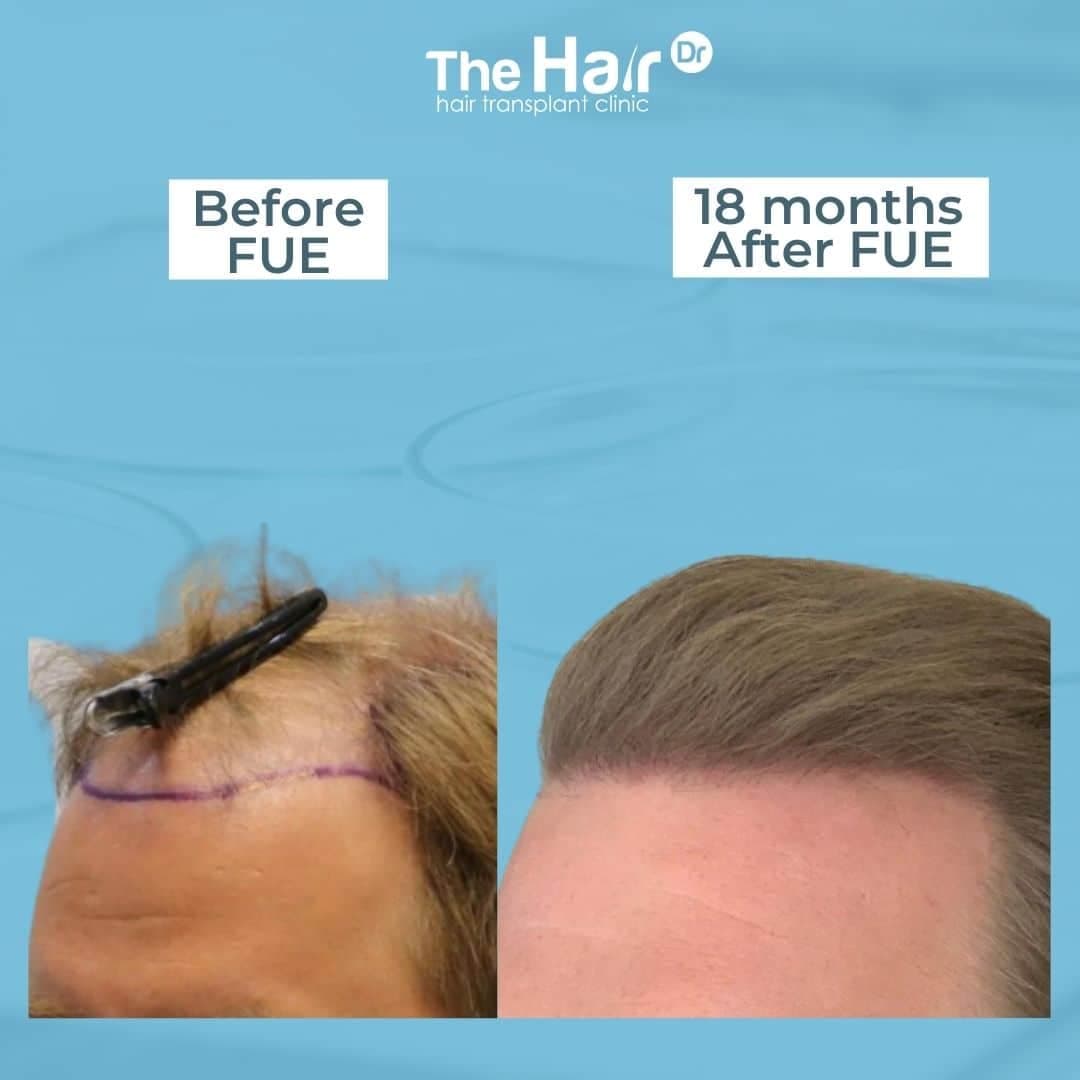 Patient transformation slide 4