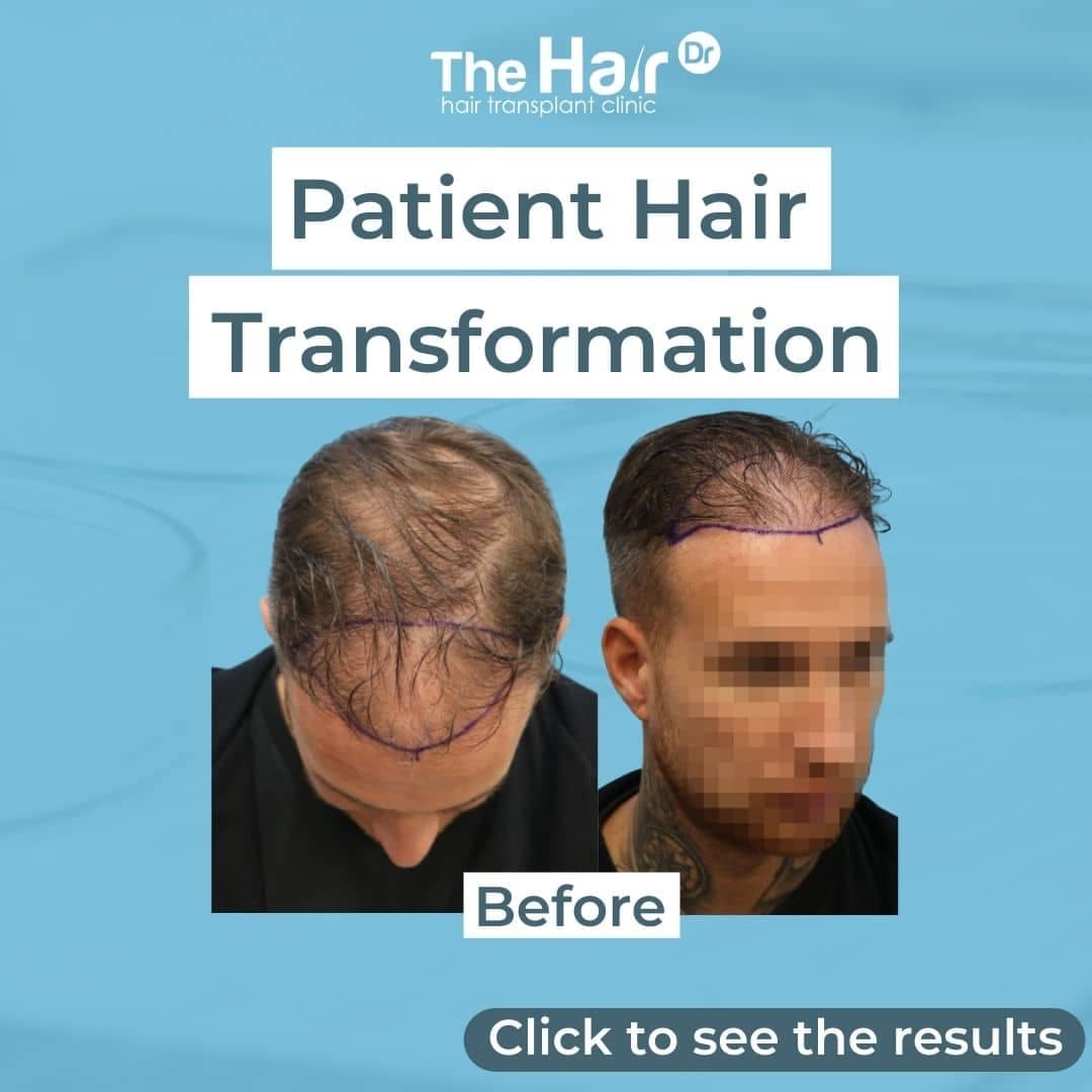 Patient transformation slide 1