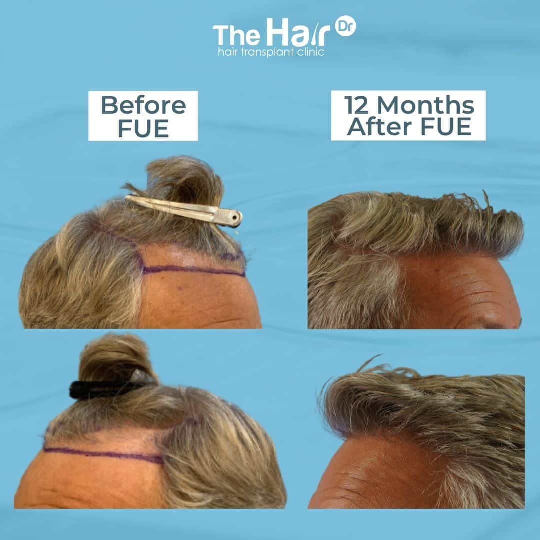 Patient transformation slide 7