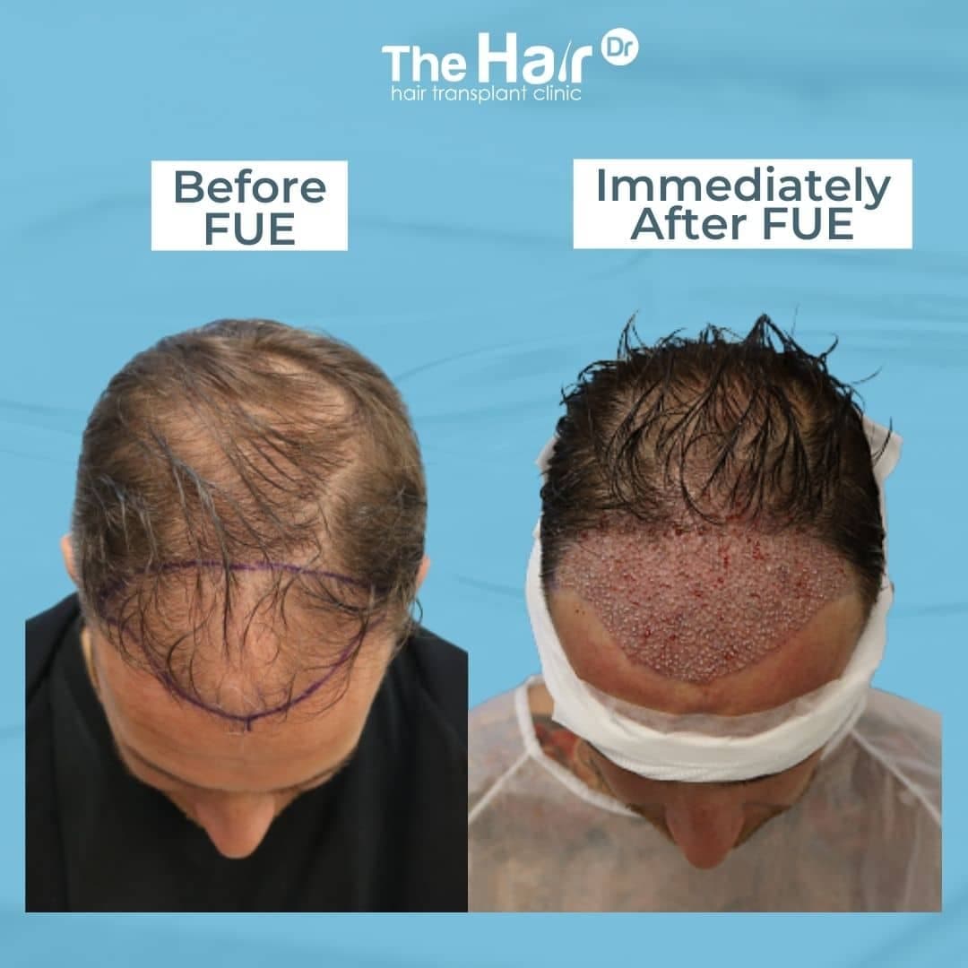 Patient transformation slide 3