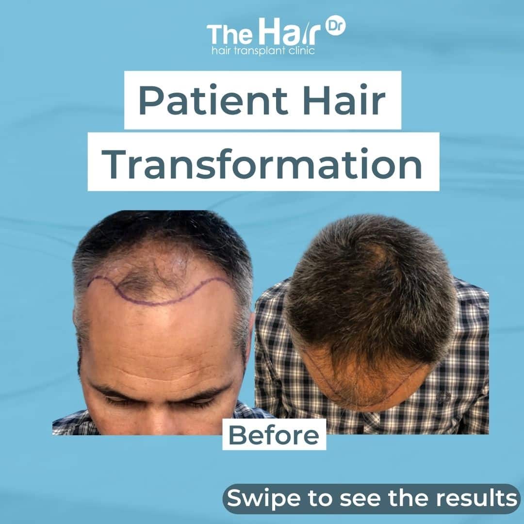 Patient transformation slide 1