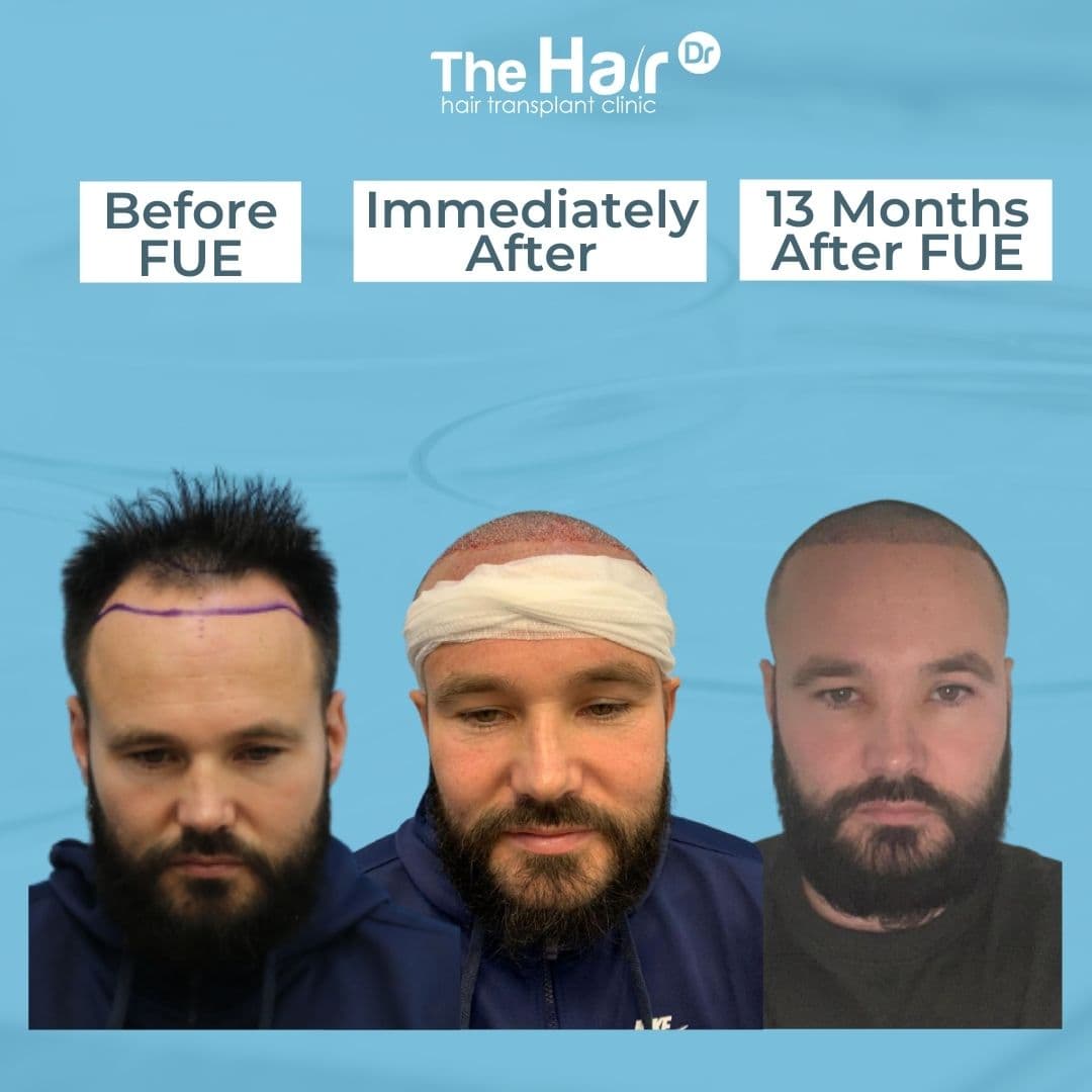 Patient transformation slide 3