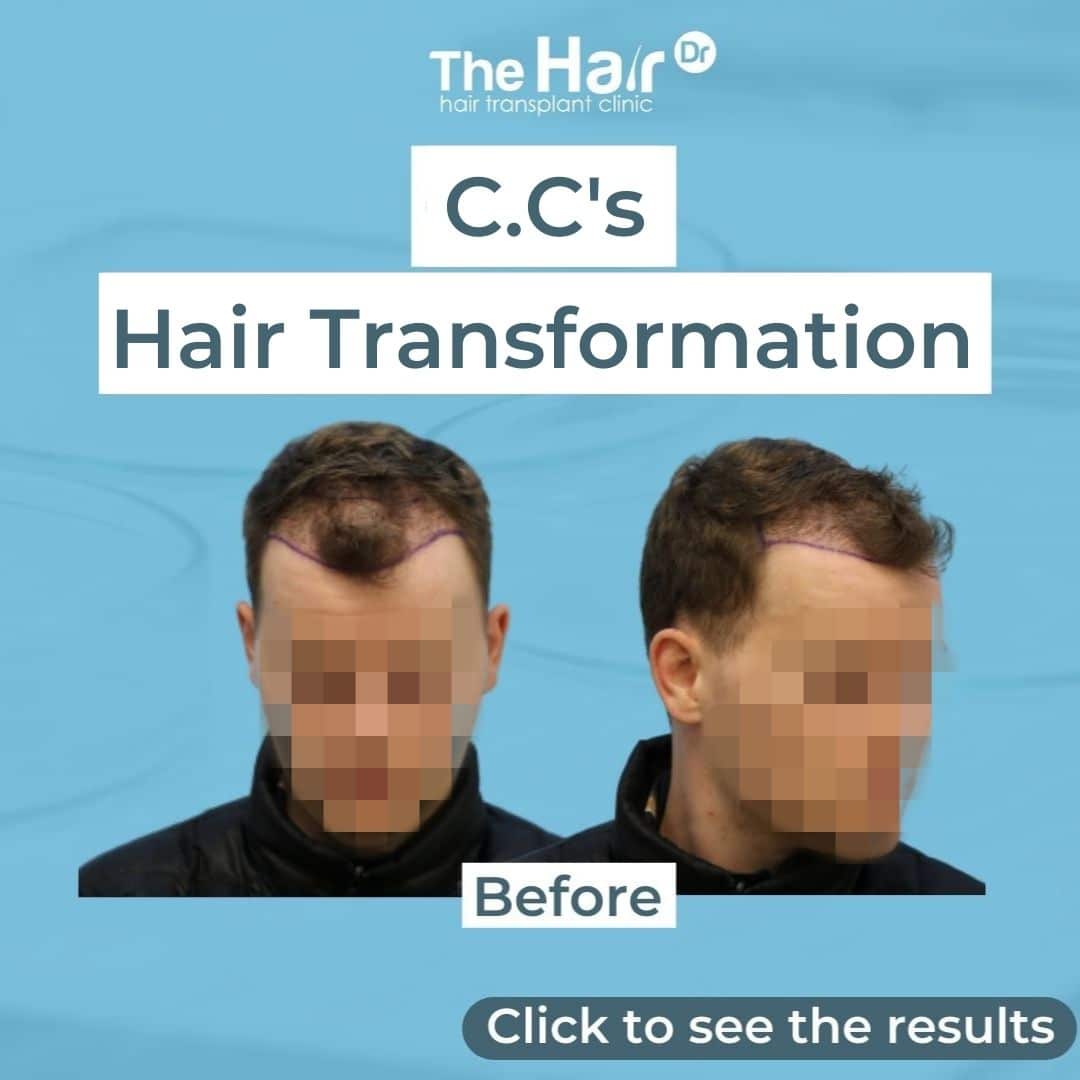 Patient transformation slide 5