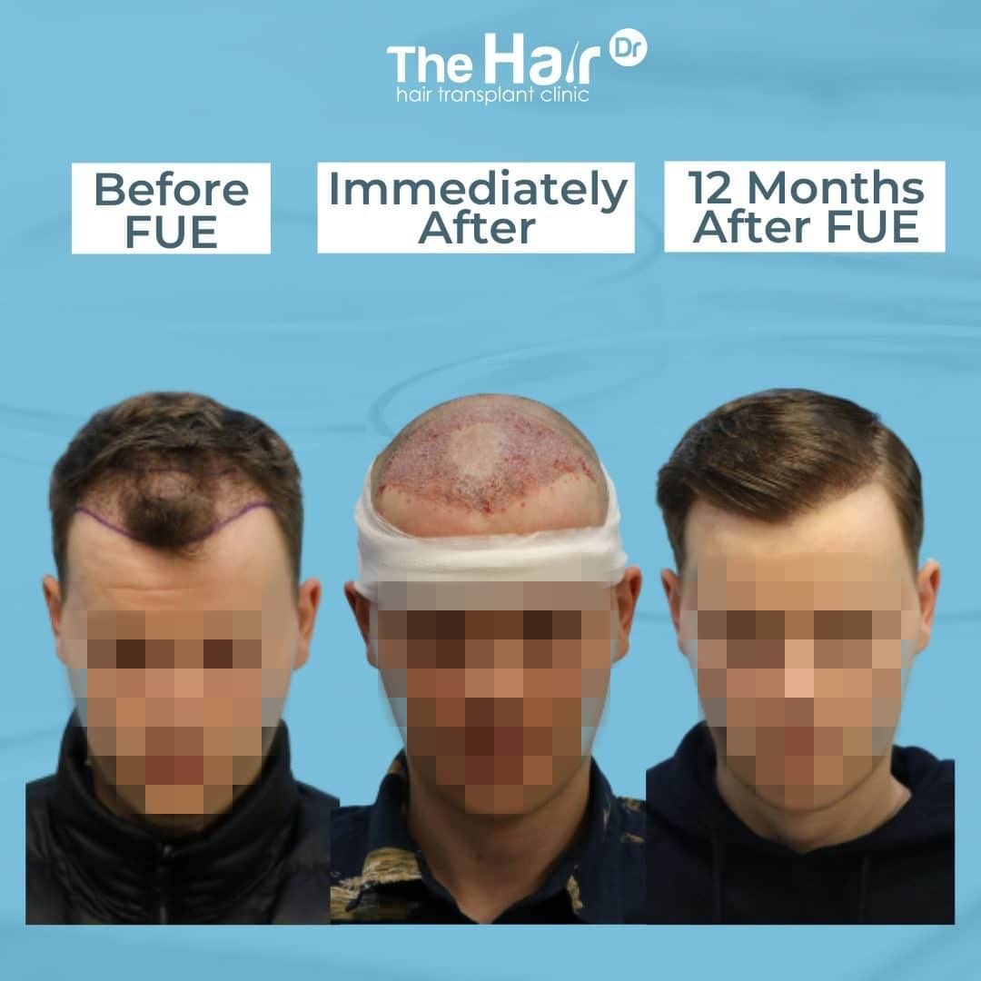 Patient transformation slide 3