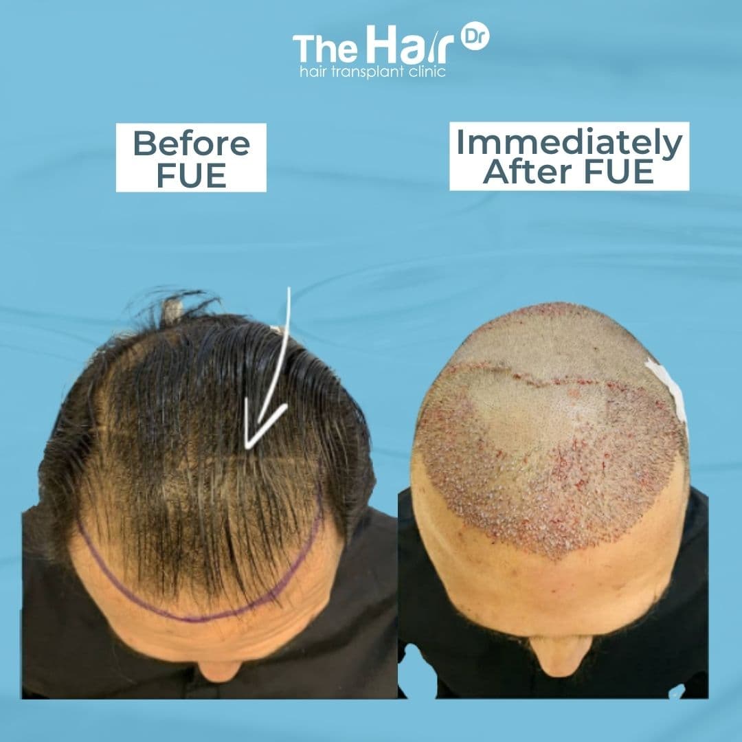 Patient transformation slide 3