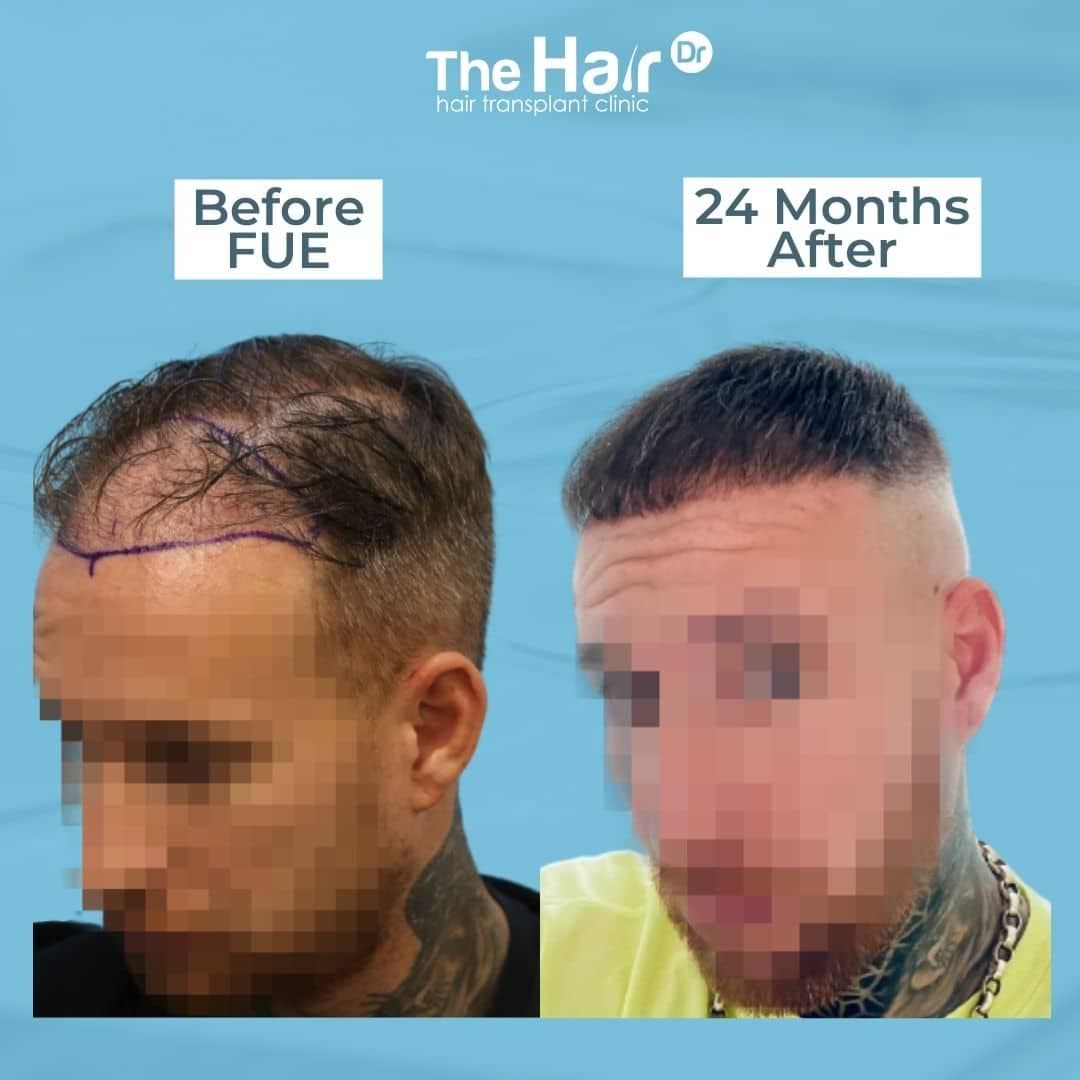 Patient transformation slide 9