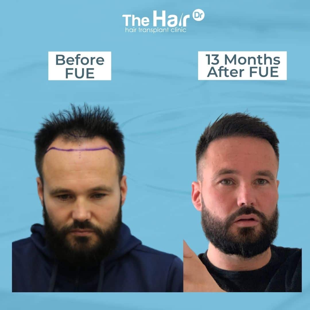 Patient transformation slide 8