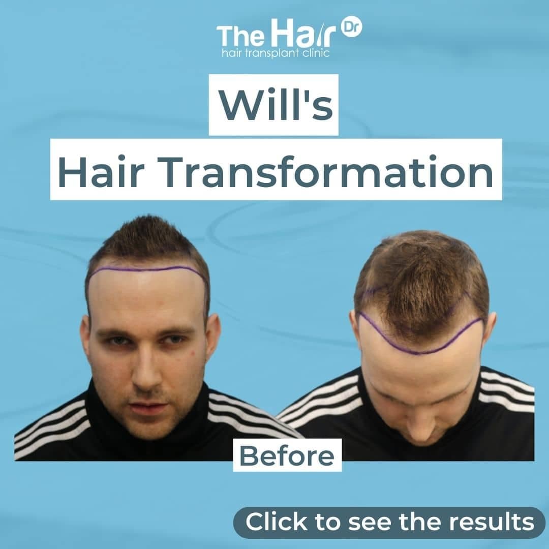 Patient transformation slide 1