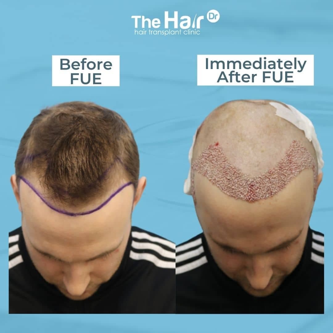 Patient transformation slide 3