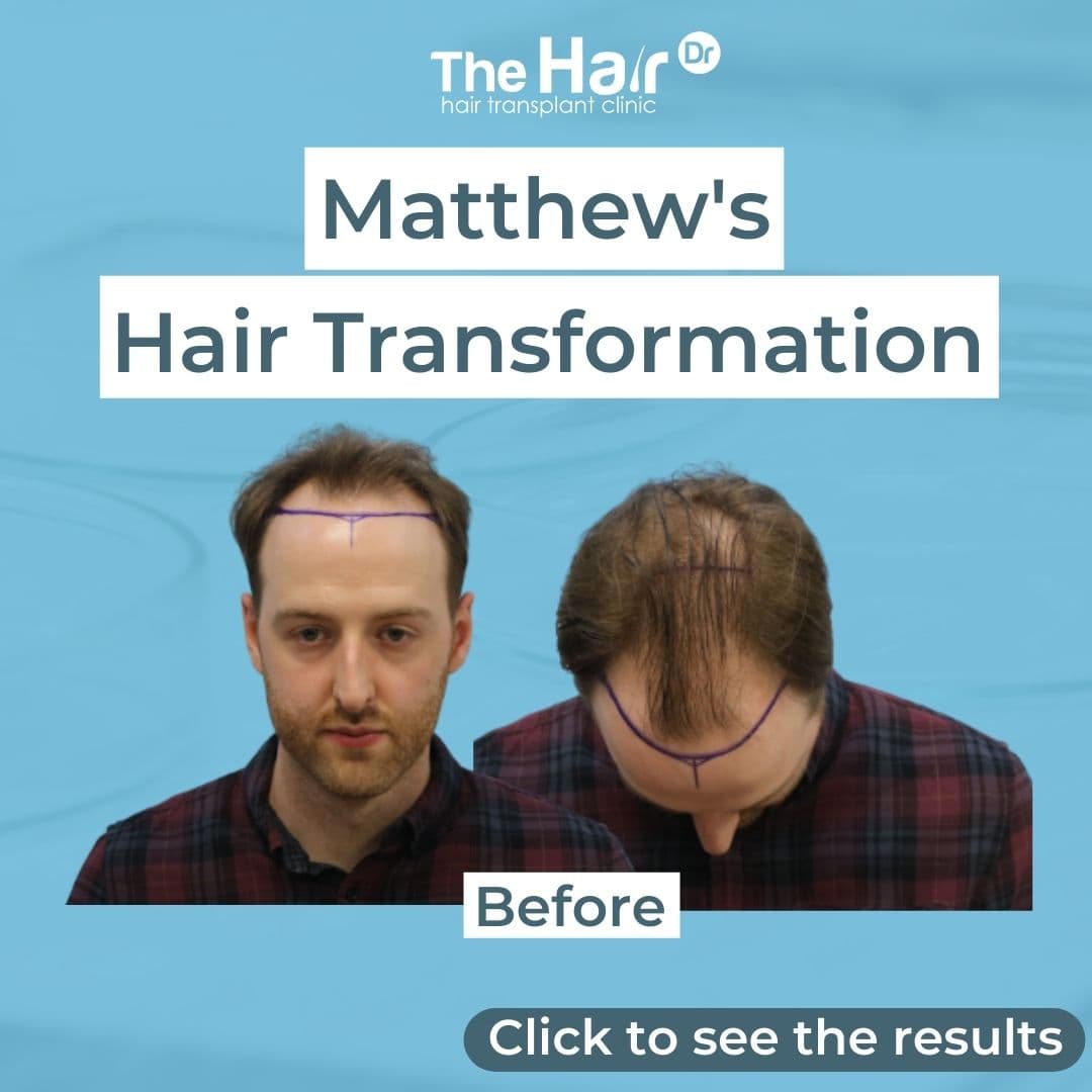 Patient transformation slide 1