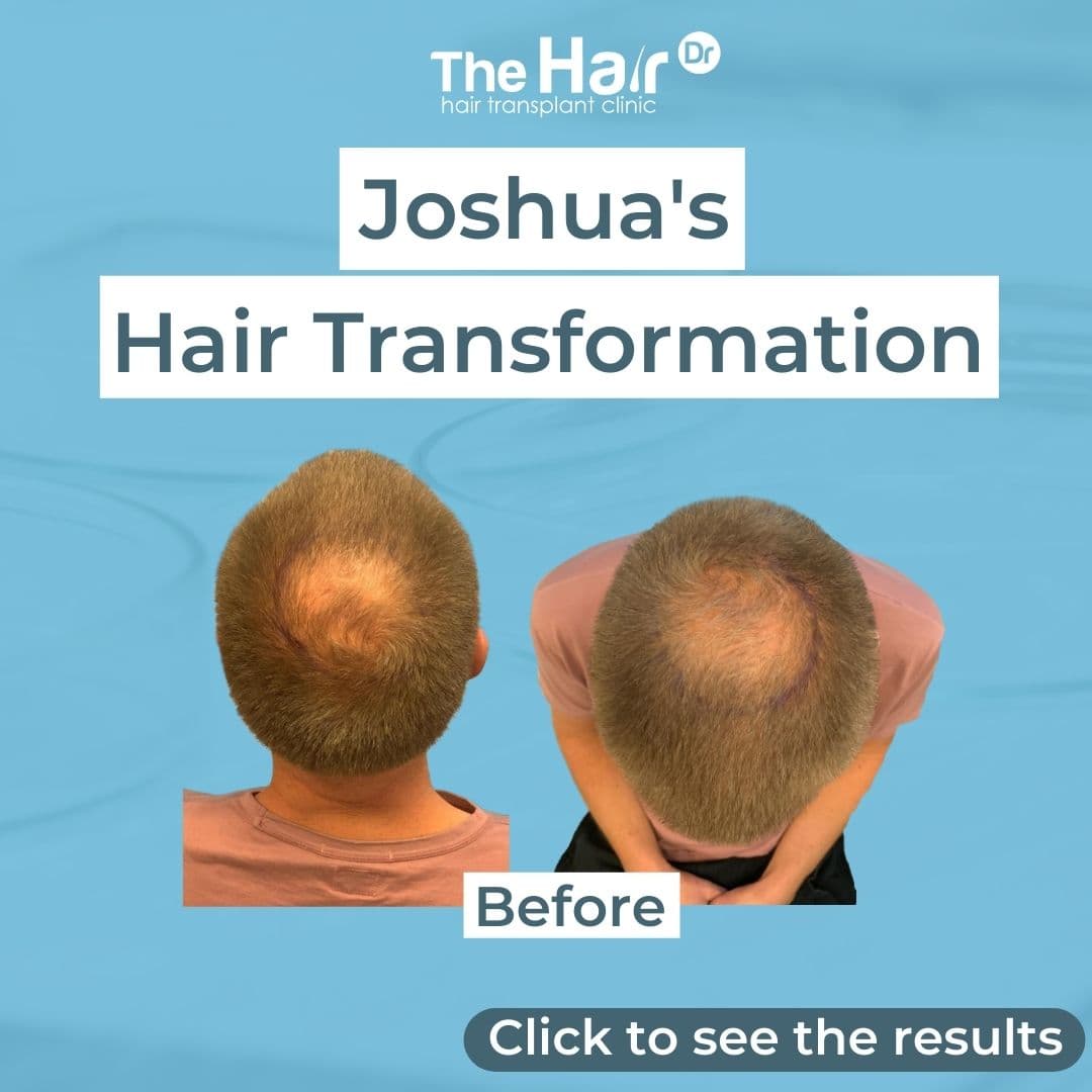 Patient transformation slide 1