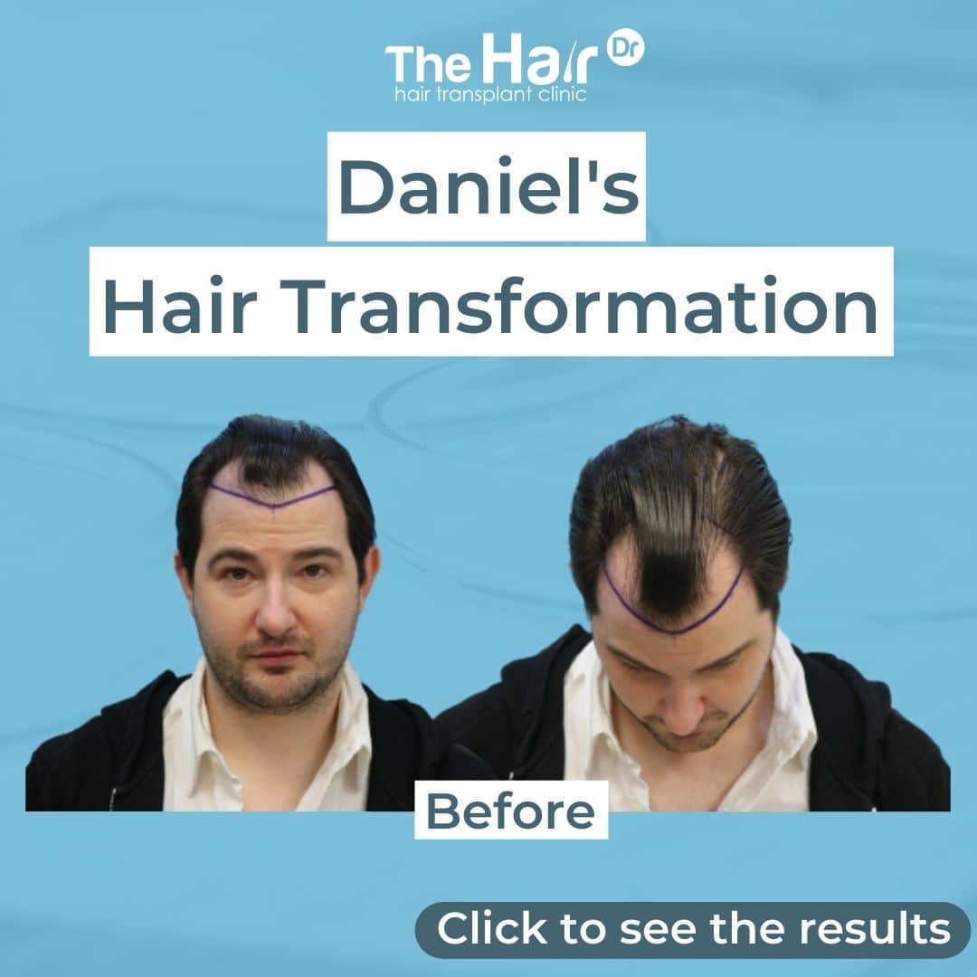 Patient transformation slide 1