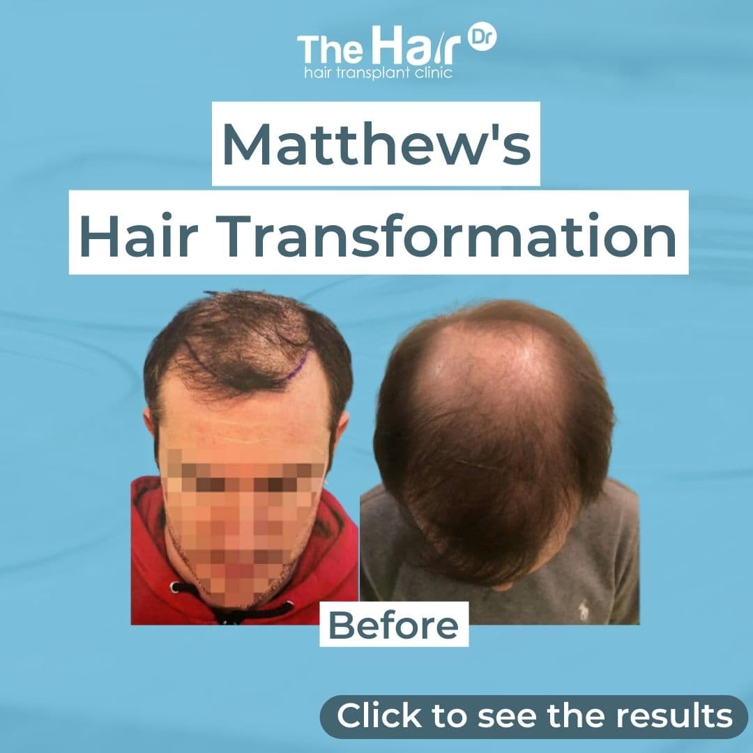 Patient transformation slide 1