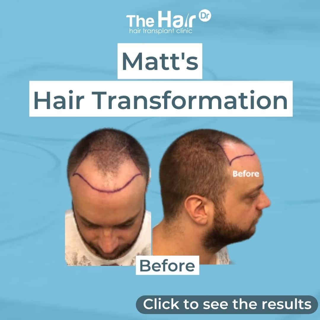 Patient transformation slide 1