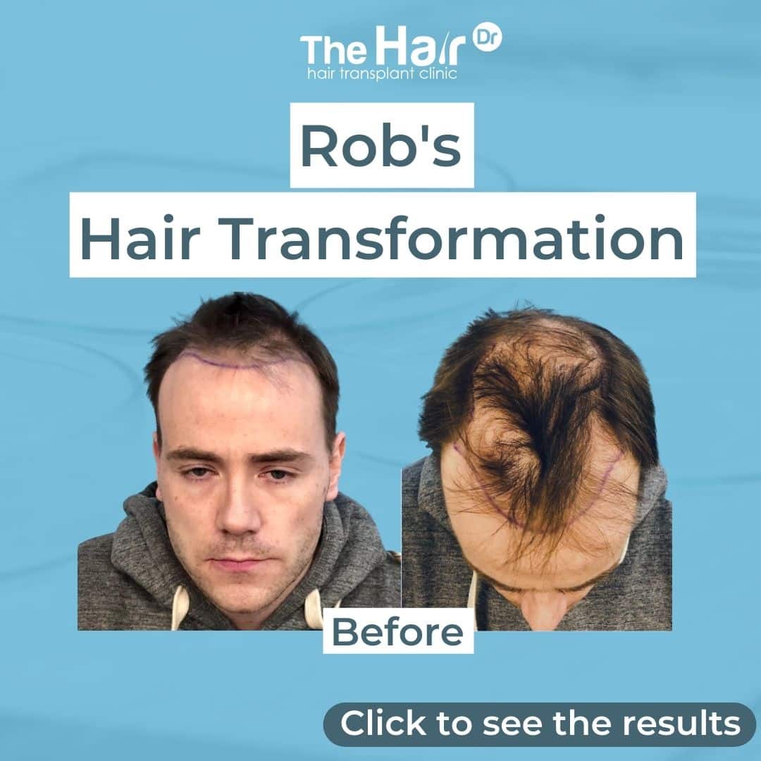 Patient transformation slide 1