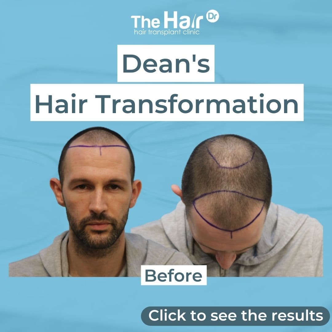 Patient transformation slide 1